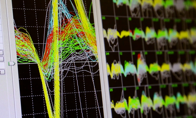 A computer in Miguel Nicolelis’s lab monitors brain signals from a rhesus macaque. Credit: Shawn Rocco/Duke Health.